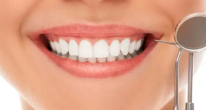 Mantenimiento periodontal - Clínica dental merino
