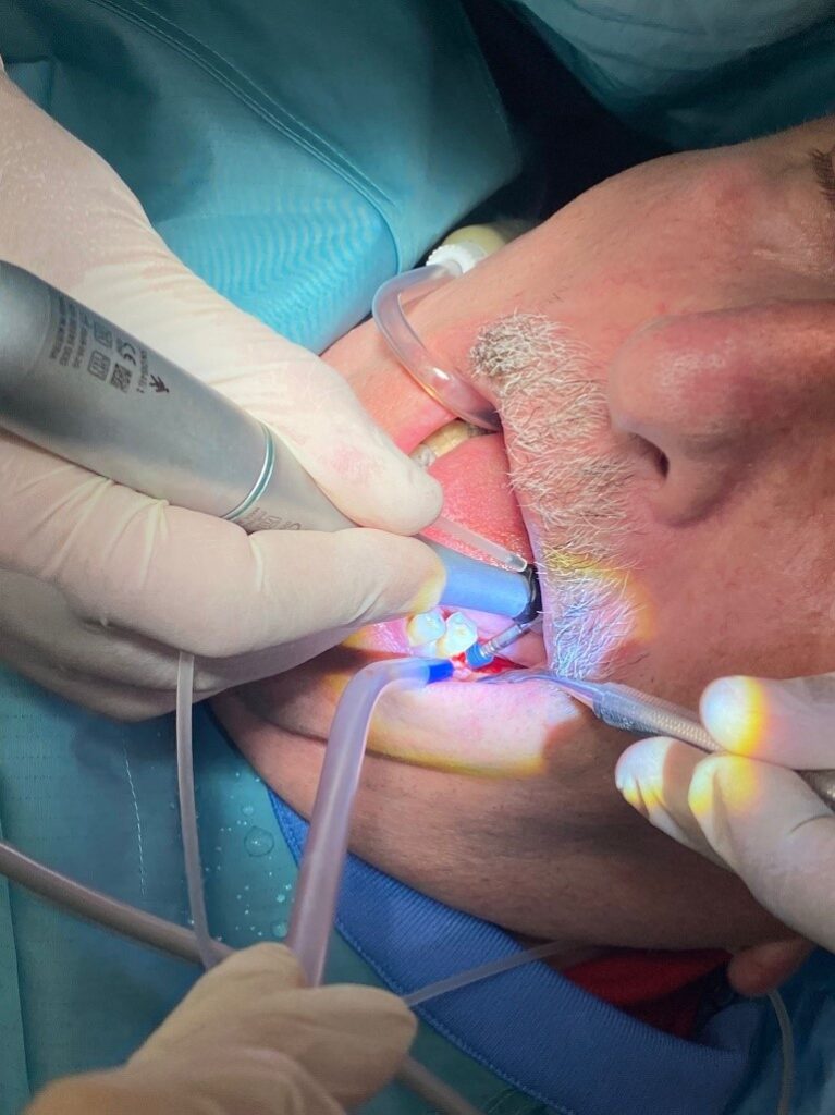 Implantes - Clínica dental Merino