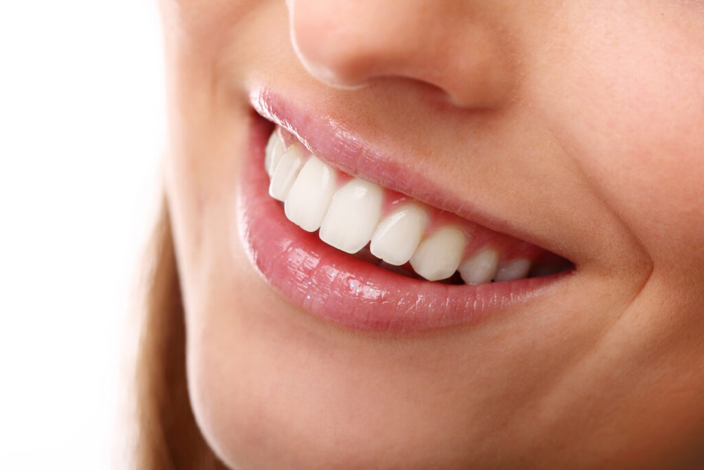 Sonrisa. Cirugía guiada implantes dentales.